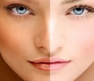 Bronzarea organica la Maraviglia