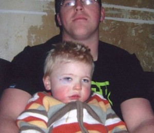 Josh Hodkins cu ochiul invinetit in urma unui accident