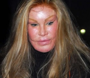 Jocelyn Wildenstein