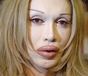 Pete Burns