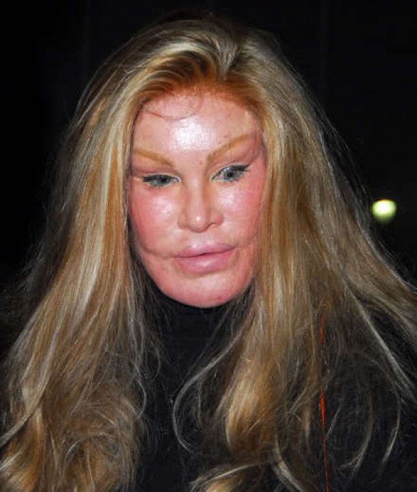 Jocelyn Wildenstein