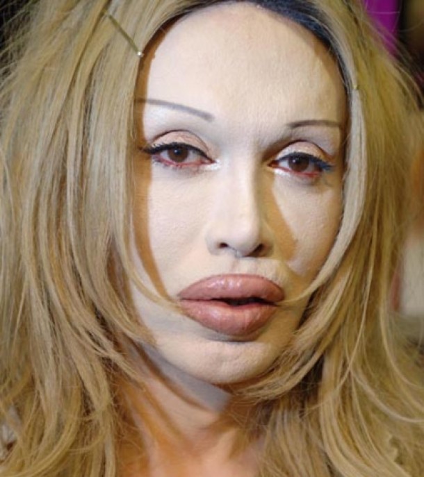 Pete Burns