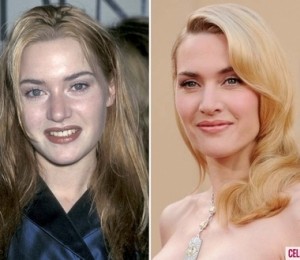 Kate Winslet