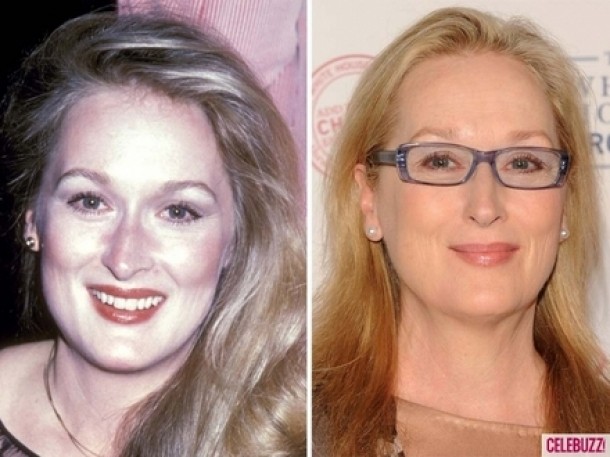 Meryl Streep