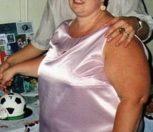 Jayne Fenney inainte de operatie