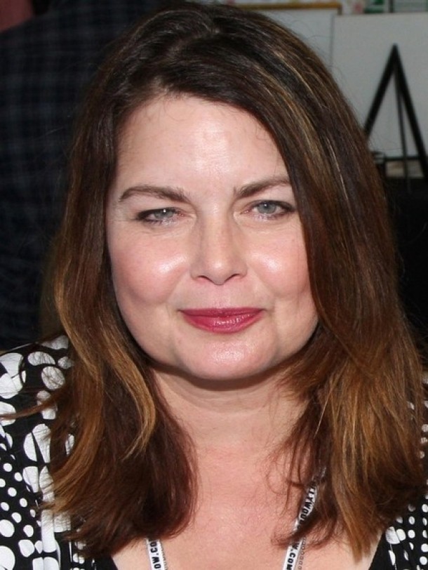 Mitzi Kapture dupa operatiile estetice