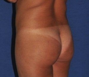 Jenny inainte de operatie