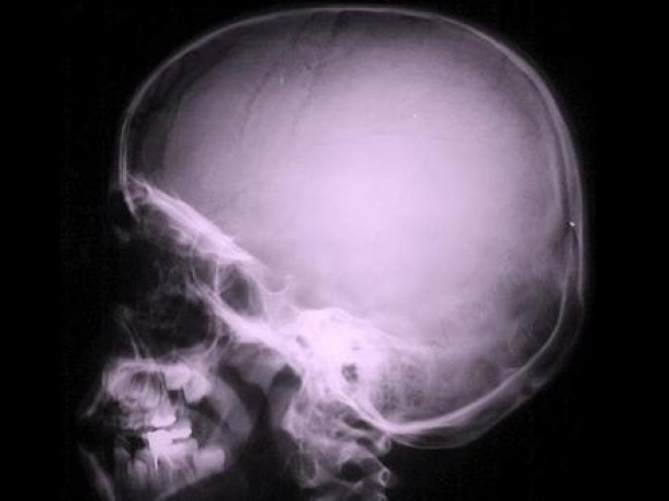 Dosarul medical al lui Hitler