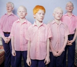 Baietii orbi, albinosi, la orfelinat in India, 2013