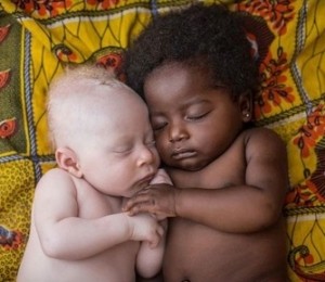 Nou nascut de 3 saptamani care sufera de albinism, doarme cu varul sau din Kinshasa, Congo. Poza de Patricia Willocq