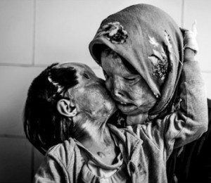 O mama si fiica sa de 3 ani care au fost atacate cu acid de sot, tata