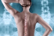 Osteoporoza