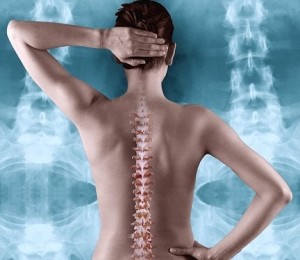 Osteoporoza