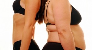 obezitate colona vertebrala