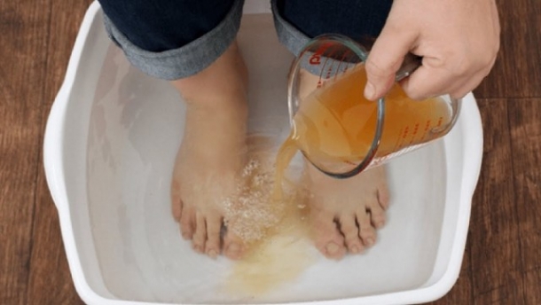 Tratarea varicelor pahar de oțet cu apă ,edemul picioarelor cu varice și metode de tratament