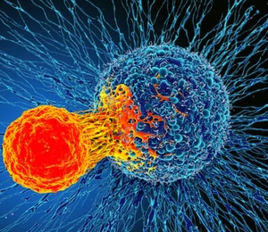 cancer celule canceroase
