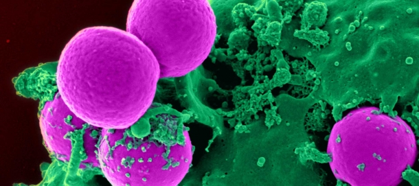 MRSA